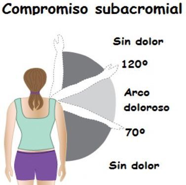 Sindrome subacromial 2