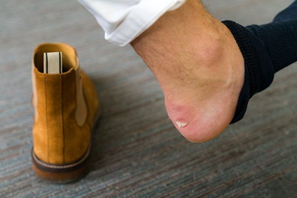 Problemas más típicos que sufren los pies en verano