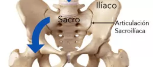 Sacroileitis