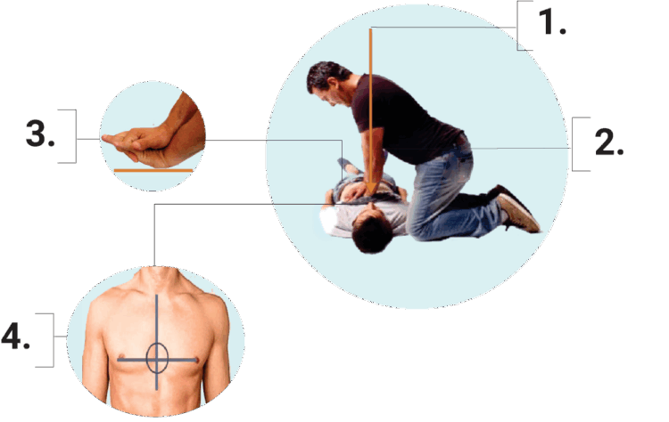 importancia de la apofisis xifoides en RCP